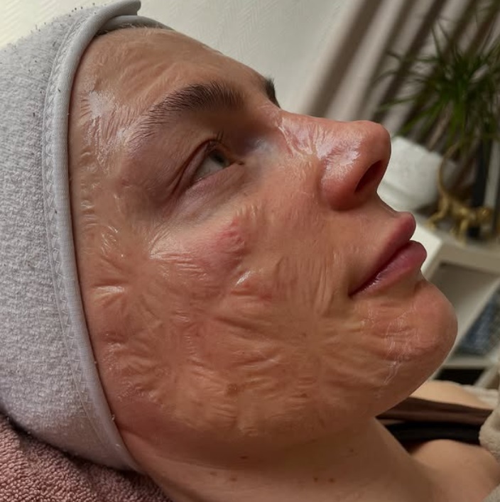 Botox armhåla hos din lokala skönhetsklinik i Östermalm